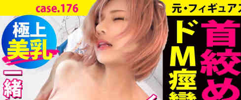 277DCV-182